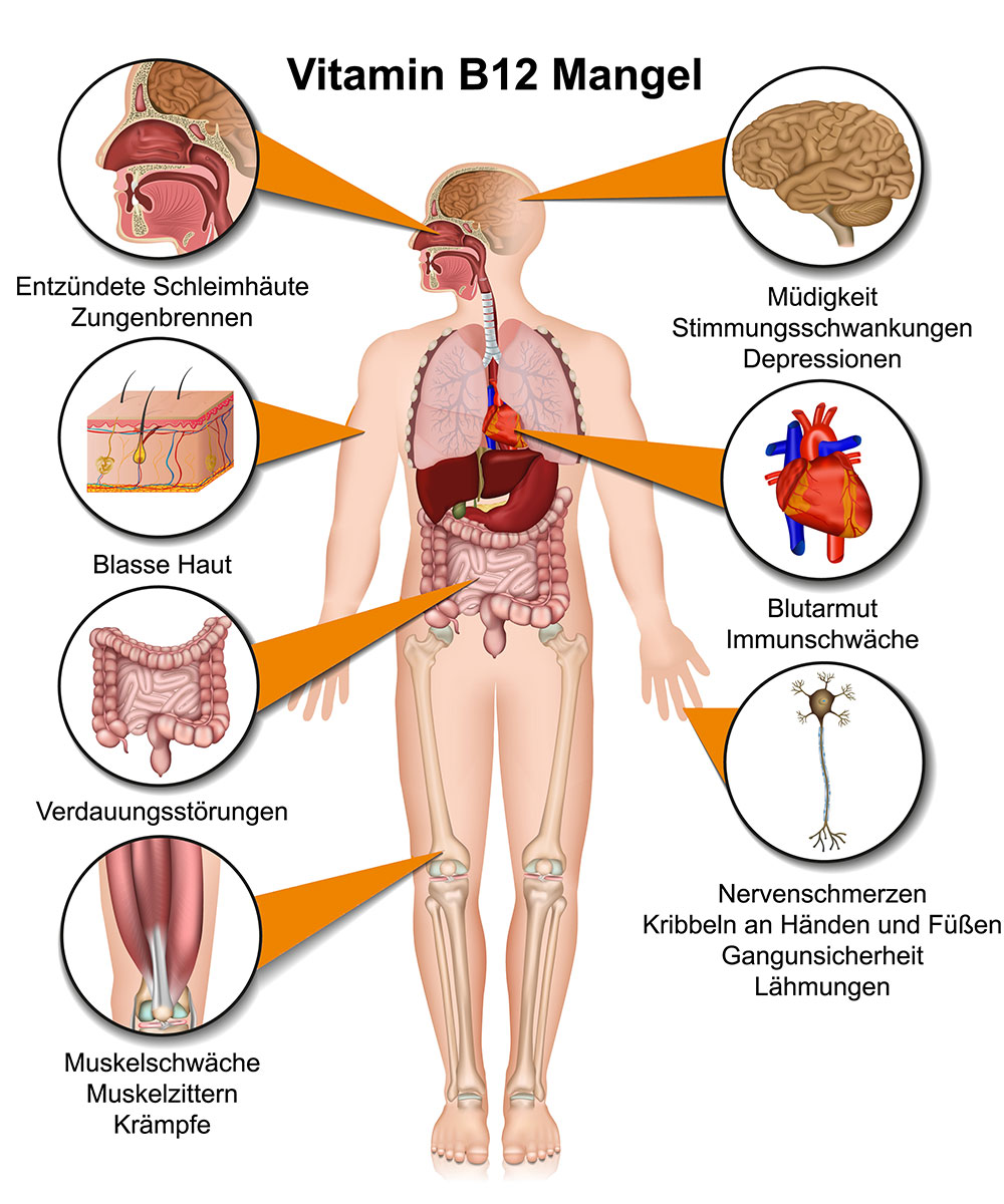 Vitamin B12 Mangel Symptome